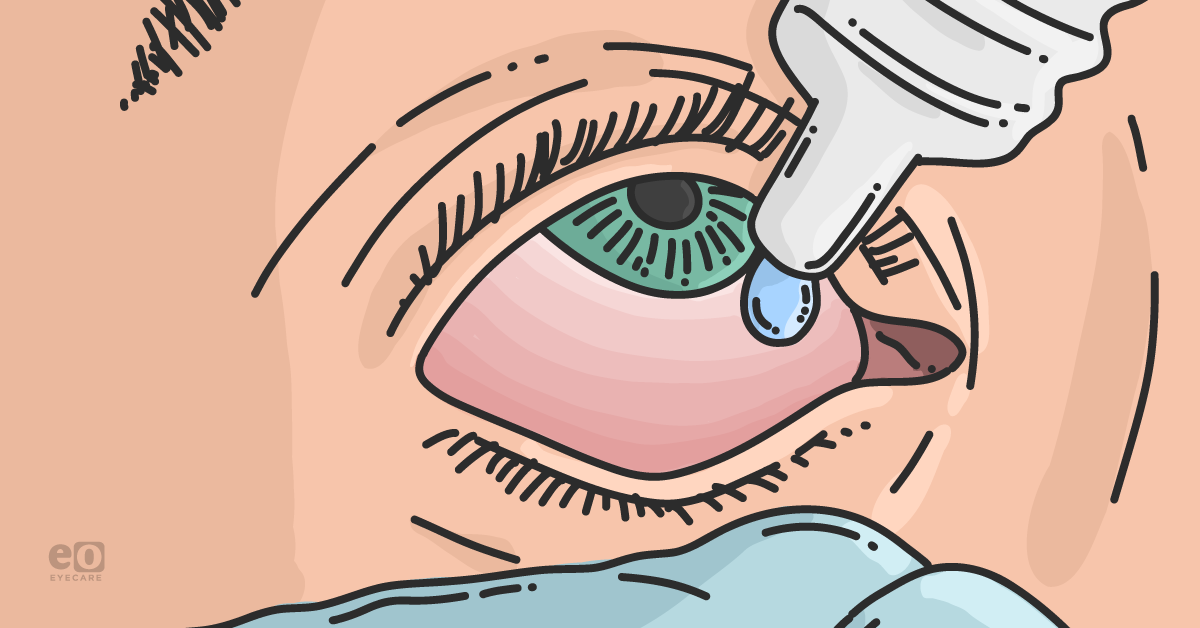 Prescribing Precision: Ocular Anti-Infectives & Corticosteroids
