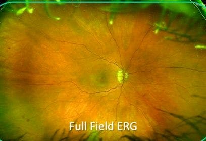 retinal image 3