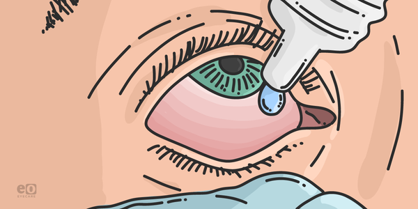 Prescribing Precision: Ocular Anti-Infectives & Corticosteroids