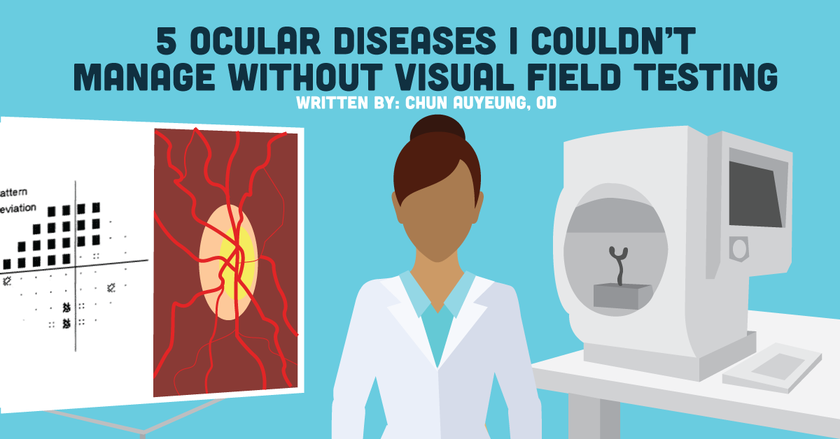 5 Ocular Diseases I Couldn't Manage Without Visual Field Testing